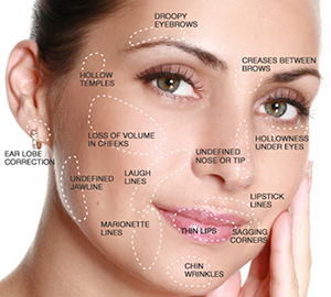 Injectable-Fillers